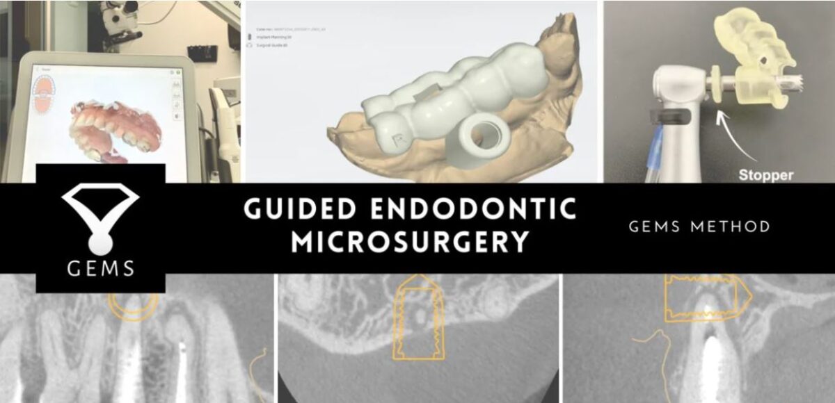 Products Cornerstone Dental Specialties CDS